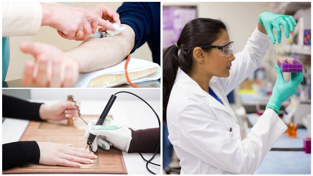 Diagnostické metódy na zistenie parazitov v tele