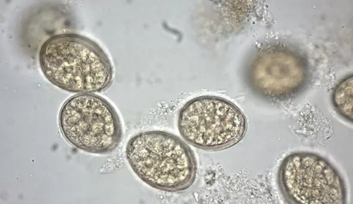 parazity pod mikroskopom