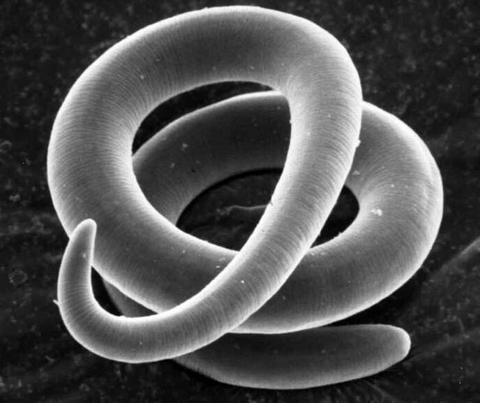 Trichinella pod mikroskopom